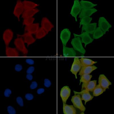C7orf61 Antibody - DF15901 staining Hela cells(45min of heat-shock treatment) by IF/ICC.