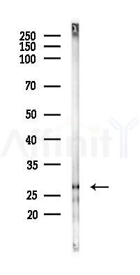 TNNI1 Antibody - Western blot analysis of lysates from Hela cells(starvation 24h treatment), using TNNI1 Antibody at 1/1000 dilution.