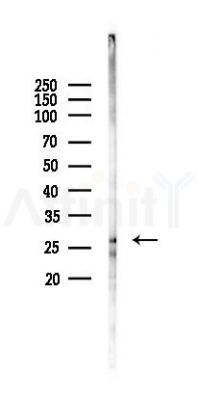 TNNI1 Antibody - Western blot analysis of lysates from HUVEC cells(starvation 24h treatment), using TNNI1 Antibody at 1/1000 dilution.