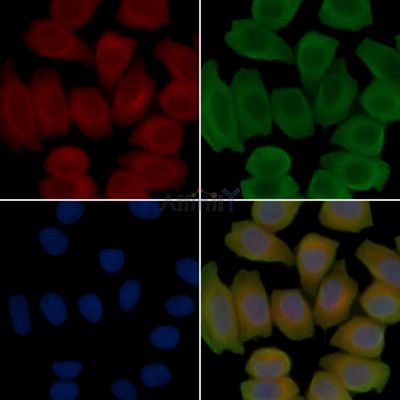 TNNI1 Antibody - DF15907 staining Hela cells(45min of heat-shock treatment) by IF/ICC.