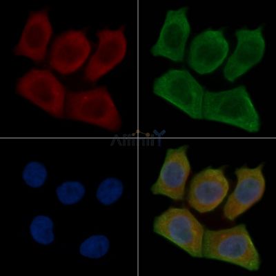 AGTRAP Antibody - DF15908 staining Hela cells(30min of UV treatment) by IF/ICC.