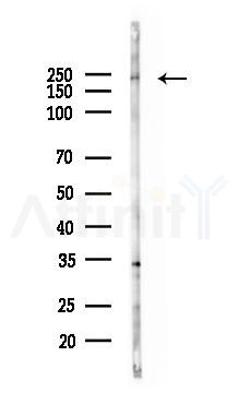 DOCK4 Antibody - Western blot analysis of lysates from Rat brain, using DOCK4 Antibody at 1/1000 dilution.
