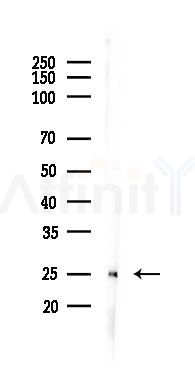 CCDC43 Antibody - Western blot analysis of lysates from Rat brain, using CCDC43 Antibody at 1/1000 dilution.