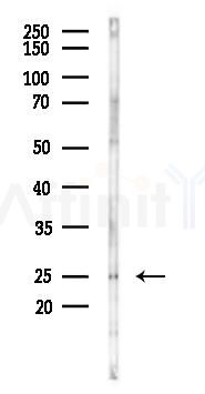 CCDC43 Antibody - Western blot analysis of lysates from Hela cells(starvation 24h treatment), using CCDC43 Antibody at 1/1000 dilution.