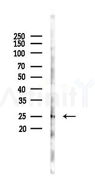 CCDC43 Antibody - Western blot analysis of lysates from HUVEC cells(starvation 24h treatment), using CCDC43 Antibody at 1/1000 dilution.