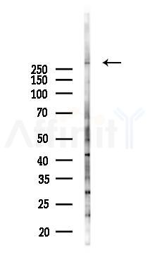 UTP20 Antibody - Western blot analysis of lysates from 293 cells(UV 30min treatment), using UTP20 Antibody at 1/1000 dilution.