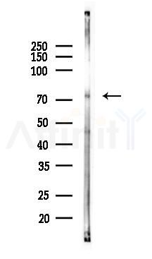 ZNF251 Antibody - Western blot analysis of lysates from Rat brain, using ZNF251 Antibody at 1/1000 dilution.