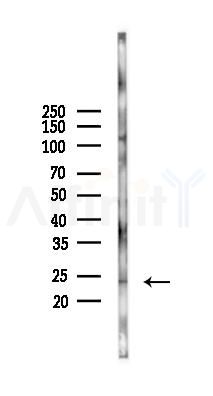 RNF186 Antibody - Western blot analysis of lysates from Mouse lung, using RNF186 Antibody at 1/1000 dilution.