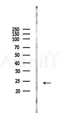 RNF186 Antibody - Western blot analysis of lysates from HUVEC cells(starvation 24h treatment), using RNF186 Antibody at 1/1000 dilution.