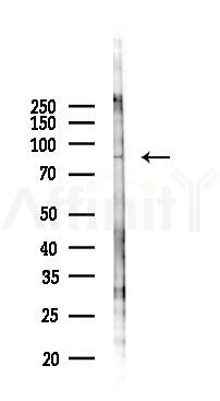 CCDC82 Antibody - Western blot analysis of lysates from 293 cells(UV 30min treatment), using CCDC82 Antibody at 1/1000 dilution.