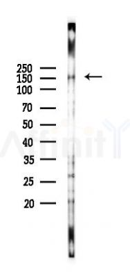 DHX57 Antibody - Western blot analysis of lysates from HUVEC cells(starvation 24h treatment), using DHX57 Antibody at 1/1000 dilution.