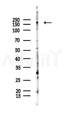 USP32 Antibody - Western blot analysis of lysates from Hela cells(starvation 24h treatment), using USP32 Antibody at 1/1000 dilution.