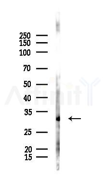 CREG2 Antibody - Western blot analysis of lysates from Hela cells(starvation 24h treatment), using CREG2 Antibody at 1/1000 dilution.