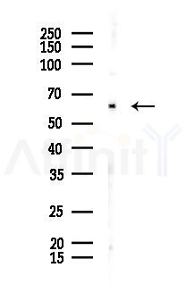 ILDR1 Antibody - Western blot analysis of lysates from Hela cells(starvation 24h treatment), using ILDR1 Antibody at 1/1000 dilution.