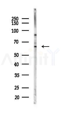 ILDR1 Antibody - Western blot analysis of lysates from 293 cells(LPS 4h treatment), using ILDR1 Antibody at 1/1000 dilution.