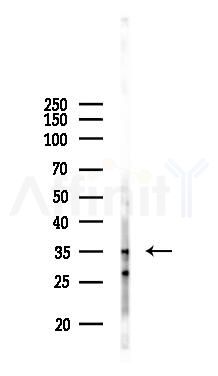 HORMAD2 Antibody - Western blot analysis of lysates from COLO205 cells(UV 30min treatment), using HORMAD2 Antibody at 1/1000 dilution.