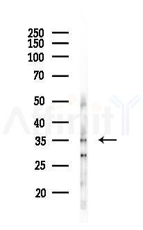 HORMAD2 Antibody - Western blot analysis of lysates from 293 cells(UV 30min treatment), using HORMAD2 Antibody at 1/1000 dilution.