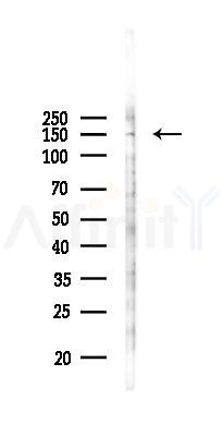 KIF15 Antibody - Western blot analysis of lysates from COLO205 cells(UV 30min treatment), using KIF15 Antibody at 1/1000 dilution.