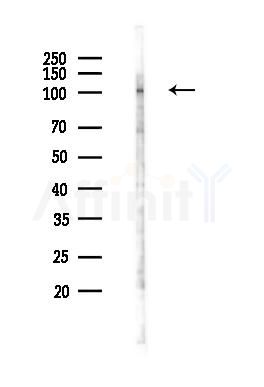 PLEKHM2 Antibody - Western blot analysis of lysates from COLO205 cells(starvation 24h treatment), using PLEKHM2 Antibody at 1/1000 dilution.
