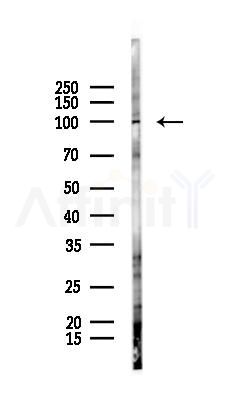 DSC1 Antibody - Western blot analysis of lysates from Hela cells(starvation 24h treatment), using DSC1 Antibody at 1/1000 dilution.