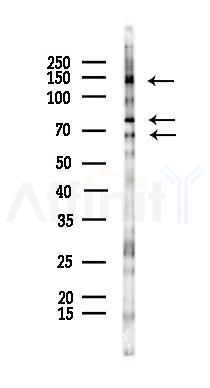 SORCS1 Antibody - Western blot analysis of lysates from Hela cells(starvation 24h treatment), using SORCS1 Antibody at 1/1000 dilution.