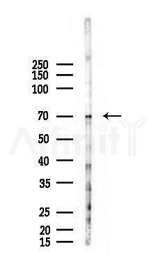 SORCS1 Antibody - Western blot analysis of lysates from 293 cells(LPS 4h treatment), using SORCS1 Antibody at 1/1000 dilution.