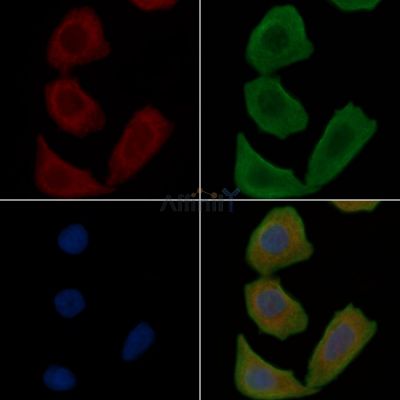 LRRC3B Antibody - DF16048 staining Hela cells(30min of UV treatment) by IF/ICC.