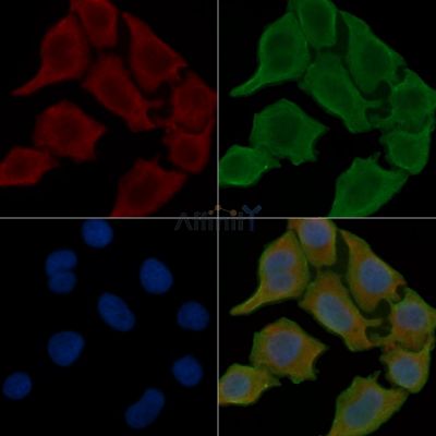 ANKRD13C Antibody - DF16067 staining Hela cells(30min of UV treatment) by IF/ICC.