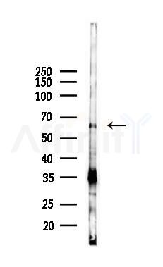 FAN1 Antibody - Western blot analysis of lysates from K562 cells(UV 30min treatment), using FAN1 Antibody at 1/1000 dilution.