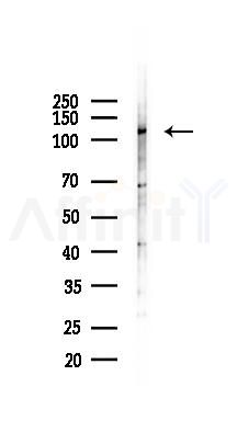 LRRCC1 Antibody - Western blot analysis of lysates from Rat lung, using LRRCC1 Antibody at 1/1000 dilution.