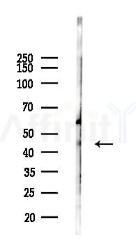 HAUS8 Antibody - Western blot analysis of lysates from B16F10-LUC cells(heat-shock 45min treatment), using HAUS8 Antibody at 1/1000 dilution.