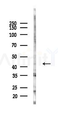 ZNF707 Antibody - Western blot analysis of lysates from K562 cells(starvation 24h treatment), using ZNF707 Antibody at 1/1000 dilution.