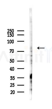 ZER1 Antibody - Western blot analysis of lysates from B16F10-LUC cells(heat-shock 45min treatment), using ZER1 Antibody at 1/1000 dilution.
