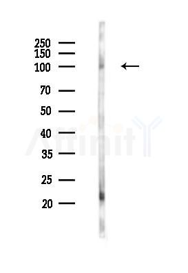 MANBA Antibody - Western blot analysis of lysates from COLO205 cells(starvation 24h treatment), using MANBA Antibody at 1/1000 dilution.