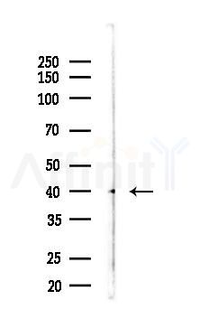 PANK1 Antibody - Western blot analysis of lysates from Hela cells(starvation 24h treatment), using PANK1 Antibody at 1/1000 dilution.
