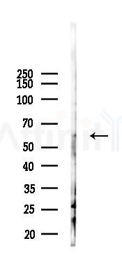 GK5 Antibody - Western blot analysis of lysates from B16F10-LUC cells(heat-shock 45min treatment), using GK5 Antibody at 1/1000 dilution.