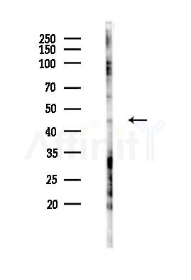 MVD Antibody - Western blot analysis of lysates from COLO205 cells(starvation 24h treatment), using MVD Antibody at 1/1000 dilution.