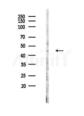 STOML1 Antibody - Western blot analysis of lysates from COLO205 cells(starvation 24h treatment), using STOML1 Antibody at 1/1000 dilution.
