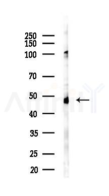 ASB4 Antibody - Western blot analysis of lysates from EC304 cells(starvation 24h treatment), using ASB4 Antibody at 1/1000 dilution.