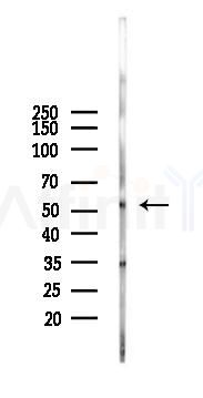 ZNF277 Antibody - Western blot analysis of lysates from Mouse brain, using ZNF277 Antibody at 1/1000 dilution.