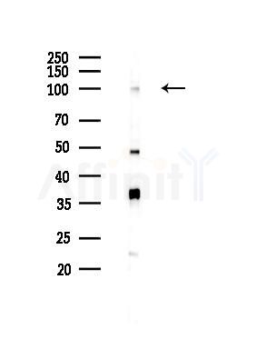 FBXO43 Antibody - Western blot analysis of lysates from COLO205 cells(starvation 24h treatment), using FBXO43 Antibody at 1/1000 dilution.