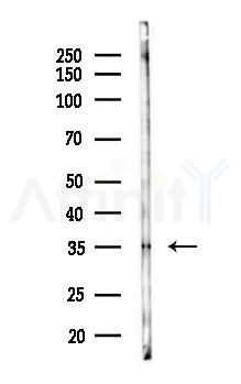 FHL5 Antibody - Western blot analysis of lysates from Hela cells(starvation 24h treatment), using FHL5 Antibody at 1/1000 dilution.