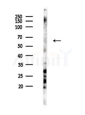 DDX56 Antibody - Western blot analysis of lysates from COLO205 cells(starvation 24h treatment), using DDX56 Antibody at 1/1000 dilution.