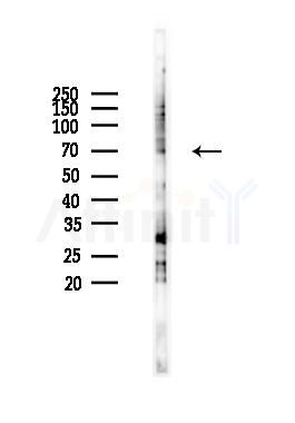 DDX56 Antibody - Western blot analysis of lysates from PC12 cells(LPS 4h treatment), using DDX56 Antibody at 1/1000 dilution.