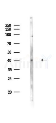 RFPL1 Antibody - Western blot analysis of lysates from COLO205 cells(heat-shock 45min treatment), using RFPL1 Antibody at 1/1000 dilution.