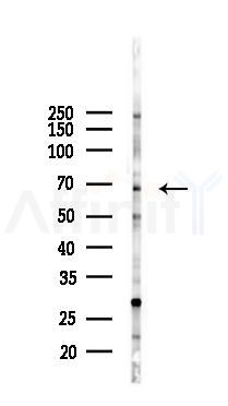SLC6A3 Antibody - Western blot analysis of lysates from K562 cells(UV 30min treatment), using SLC6A3 Antibody at 1/1000 dilution.