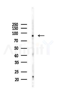 CD276 Antibody - Western blot analysis of lysates from K562 cells(UV 30min treatment), using CD276 Antibody at 1/1000 dilution.