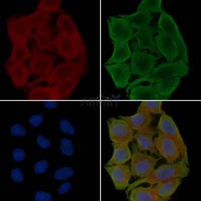 CX3CR1 Antibody - DF2325 staining Hela cells(30min of UV treatment) by IF/ICC.