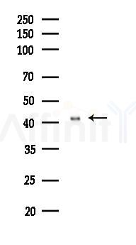 HES5 Antibody - Western blot analysis of lysates from A2780 cells(LPS 4h treatment), using HES5 Antibody at 1/1000 dilution.