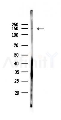 RB6I2 Antibody - Western blot analysis of lysates from Hela cells(starvation 24h treatment), using RB6I2 Antibody at 1/1000 dilution.